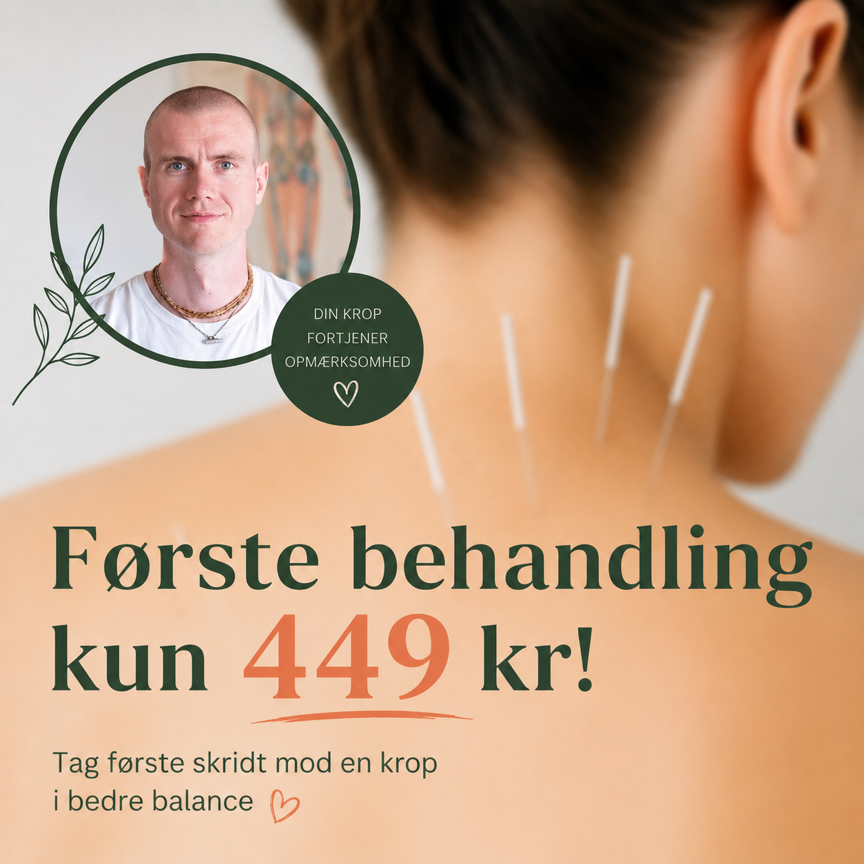 Akupunktur Mads - Køge